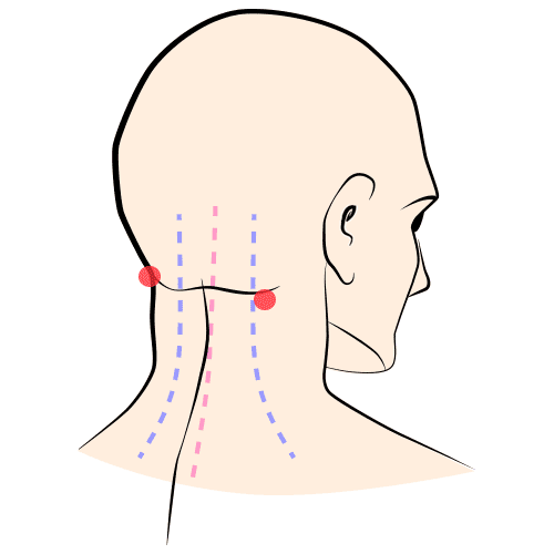 Болит шея у основания головы